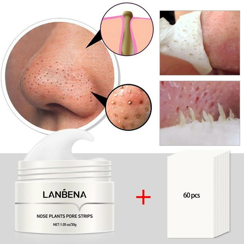 Lanbena Creme - Remove Cravos e Hidrata a Pele  +Brindes Exclusivos